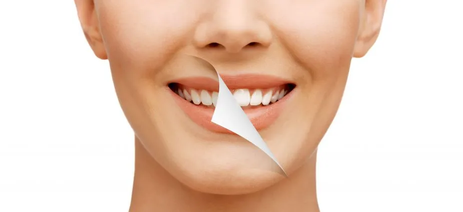Full Mouth Dental Implants Diamond Creek